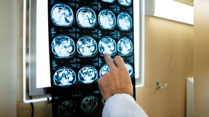 ნაპოვნია ტვინის სიმსივნეების აღმოჩენის გზა მაგნიტურ-რეზონანსული ტომოგრაფიის და ანალიზების გარეშე ნაპოვნია ტვინის სიმსივნეების აღმოჩენის გზა მაგნიტურ-რეზონანსული ტომოგრაფიის და ანალიზების გარეშე